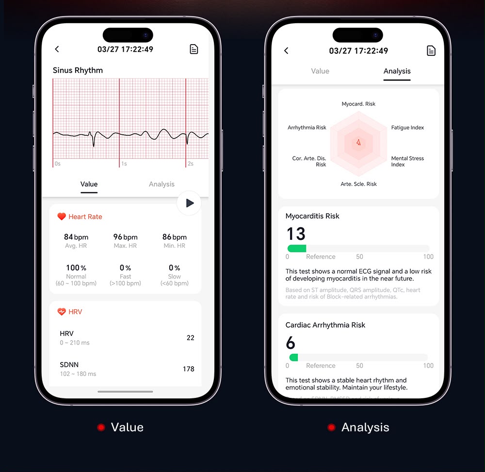 Filikar Smart Fitness Band