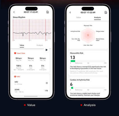 Filikar Smart Fitness Band